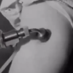 1960s Vaccine Injector — “Ped-O-Jet”